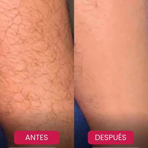 Depiladora Indolora Lumicrystal™