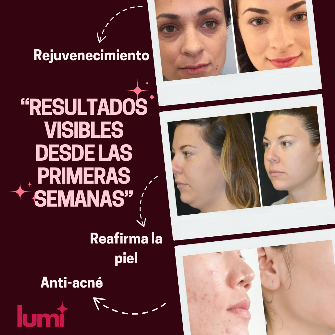 Moldeador Facial LumiGlow™