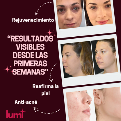 Moldeador Facial LumiGlow™